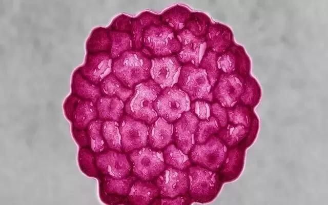 HPV56阳性可以先备孕吗？