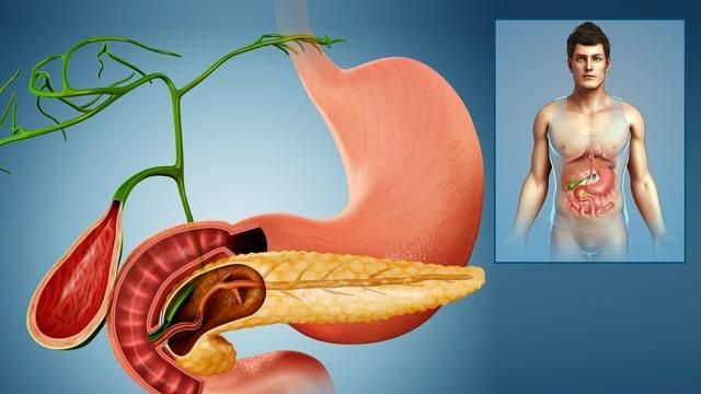 胰腺炎患者出院后的饮食方面应该注意哪些？
