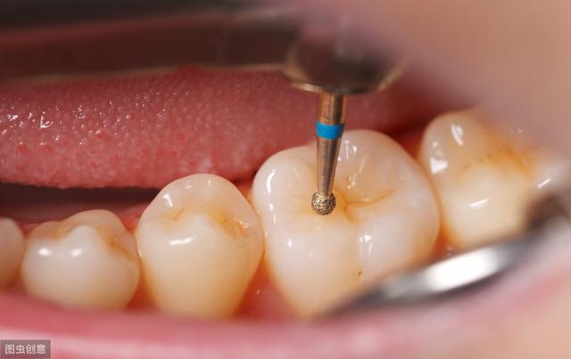 洗牙真的伤牙吗？为什么洗牙之后容易牙齿敏感？口腔医生为你揭秘