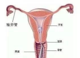 输卵管堵塞能自愈吗？还可能会怀孕吗？