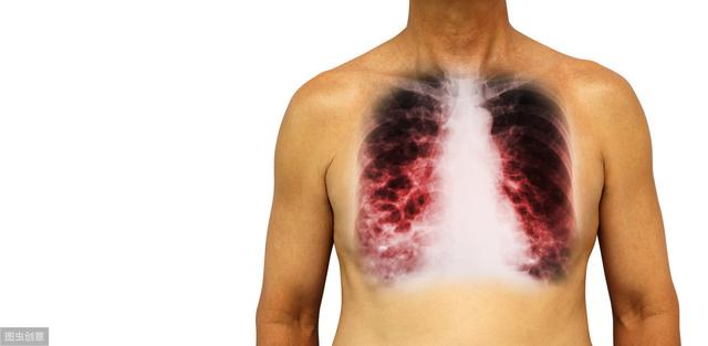 常吃木耳和猪血，可以清肺预防肺癌吗？搞清楚这4点才有用
