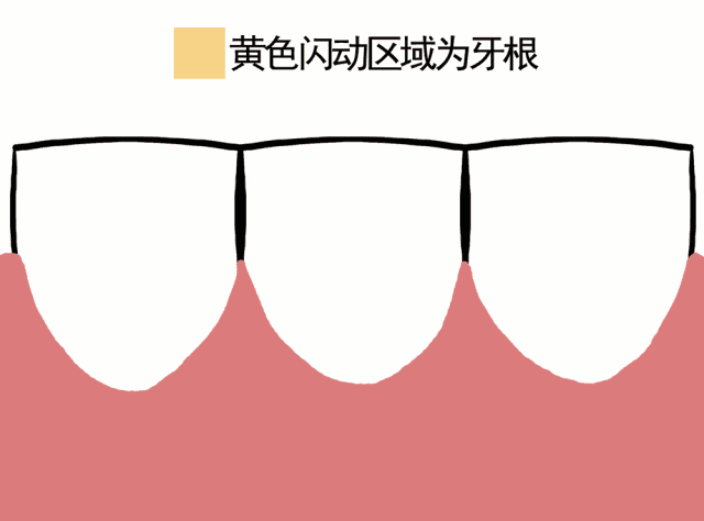牙龈萎缩导致牙齿松动，生涯饮食倍受影响，牙医告诉你真正的元凶