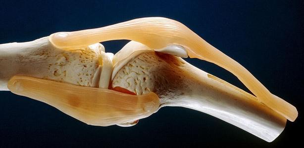 软骨磨损是骨关节炎泉源，软骨修复术可治愈骨关节炎吗？